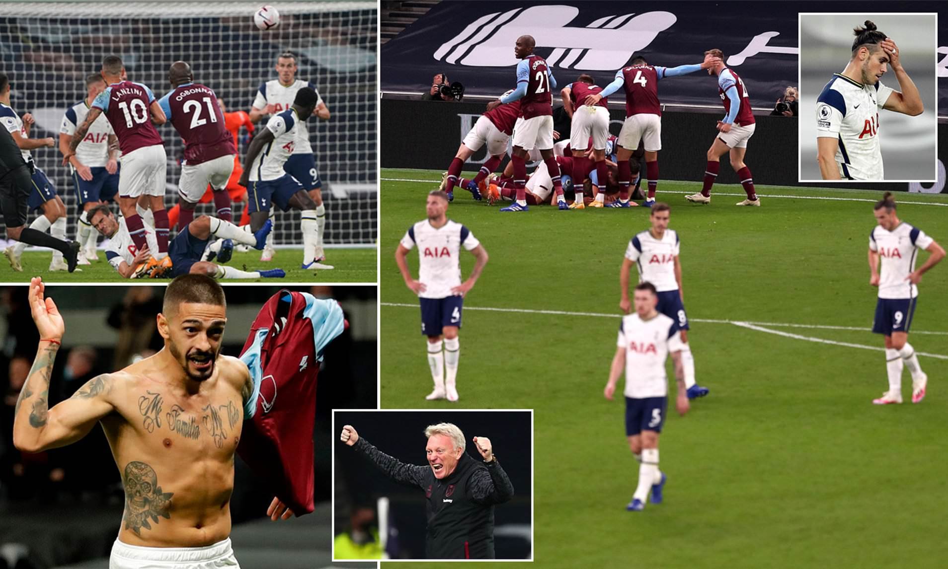 带拉伤与郑 带拉伤与郑